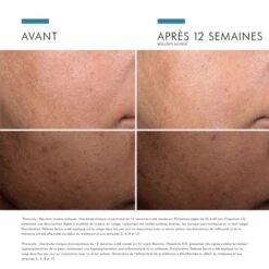 SkinCeuticals Discoloration Defense Serum - Contenance : 30 Ml 16 SkinCeuticals Discoloration Defense Serum - Contenance : 30 Ml -René furterer Soldes Magasin 736b696e636575746963616c732d646973636f6c6f726174696f6e2d646566656e73652d736572756d2d36a856e061