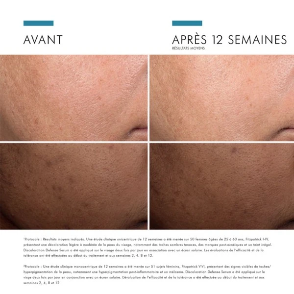 SkinCeuticals Discoloration Defense Serum - Contenance : 30 Ml 8 SkinCeuticals Discoloration Defense Serum - Contenance : 30 Ml – Image 8