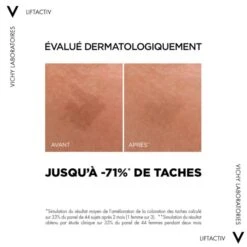 Vichy Liftactiv Specialist B3 Serum - Contenance : 30 Ml -René furterer Soldes Magasin 76696368792d6c69667461637469762d7370656369616c6973742d62332d736572756d2d3446dcd7b9